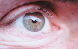 Degeneración Macular Asociada a la Edad