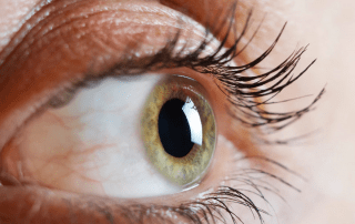 Cross-linking Novovisión