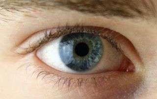 Corrección visual con láser