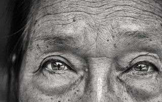 degeneración macular húmeda