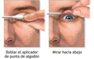 eversión del párpado