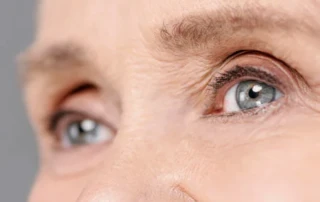 Qué son las Cataratas