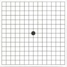 Rejilla de Amsler: Mácula no afectada por DMAE.